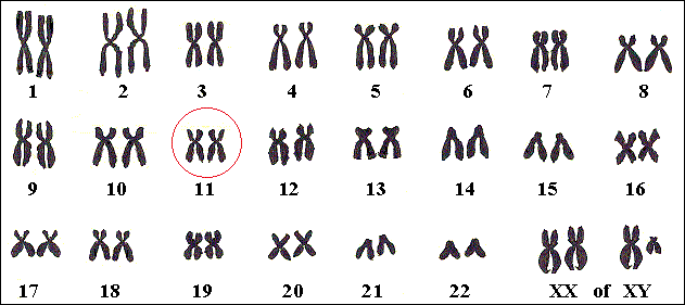 Het gen voor Acromegalie ligt op chromosoom nummer 11 en is dominant.