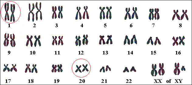 Het gen voor Alagille ligt op het twintiste of op het eerste chromosoom. Nog niet alle Alagille-genen zijn ontdekt.