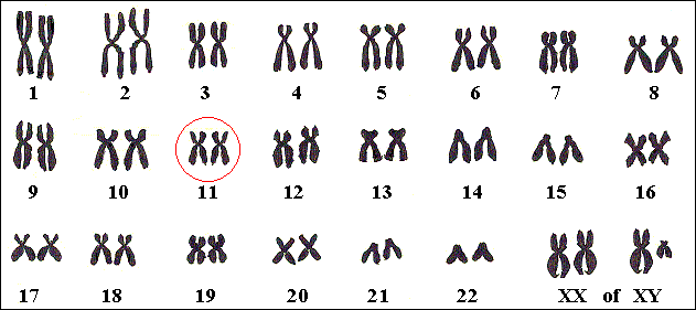 Chromosoom nr 11 is de plaats waarop de mutatie ligt.