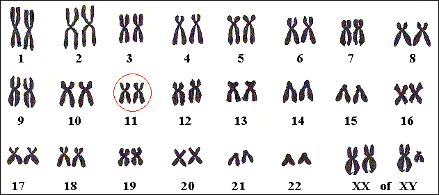 Bij het syndroom van Jacobsen ontbreekt een stukje van chromosoom nr 11, meer bepaald een stuk van de lange arm.