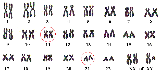 Genen voor Jervell-Lange-Nielsen liggen op de chromosomen 11 of 21.