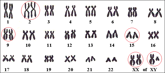 Verschillende LGS-genen liggen op verschillende chromosomen.