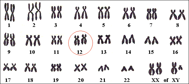 De meest voorkomende Noonan-situatie: een gen op chromosoom 12.