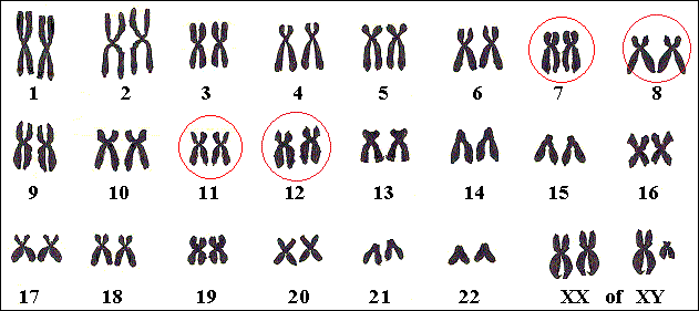 Genen op verschillende chromosomen kunnen Russell-Silver veroorzaken.