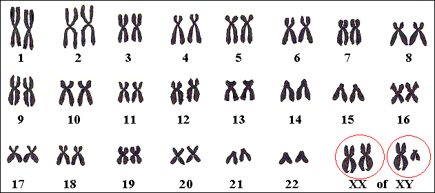 De 46 menselijke chromosomen. Het gen voor Hemofilie ligt op het X-chromosoom.