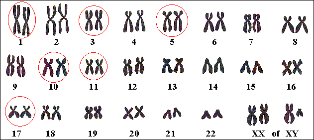 Genen op verschillende chromosomen kunnen Usher veroorzaken.